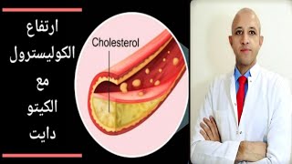 ١٧٧) السر وراء ارتفاع الكوليسترول مع الكيتو دايت ‼ معلومة في دقيقة
