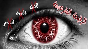 رقية شرعية  بصوت  الشيخ محمود أبو سعدة #السحر.العين.الحسد