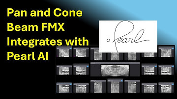 ImageWorks Cone Beam and Pano FMX Clipping with Pearl AI