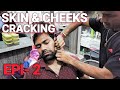 Skin and cheeks cracking head massage Episode 2