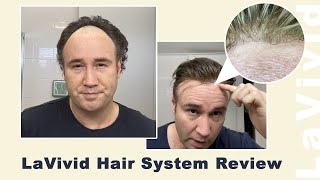 Hair Again, Confident Again|LaVivid Hair System