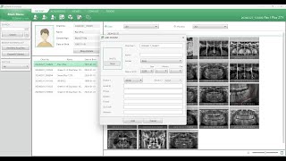 How to Add patient, modify and delete in Vatech EzDent i | patient technology