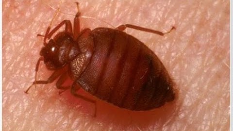 Bed bugs running...  They are fast.