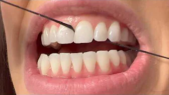 The Trick That Finally Made Me Love Flossing