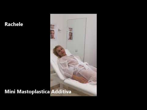 Video testimonianza Mini Mastoplastica Additiva Rachele