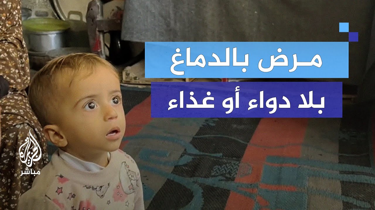 ذو عامين.. معاناة طفل فلسطيني مريض في ظل الحرب