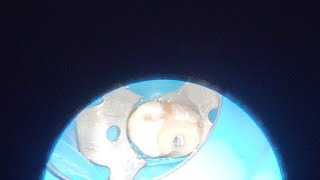 картинка: 16 перелечивание