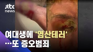 또 증오범죄…뉴욕서 아시아계 여대생 염산테러 당해 / JTBC 아침&