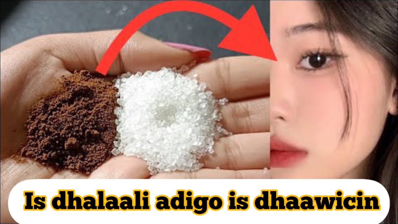 Qolofta wajiga qayiraada iyo qalelka #isdhalaali #adigo #isdhaawicin