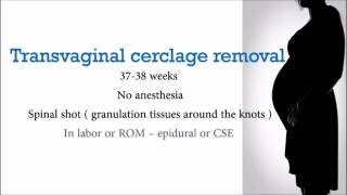 3min anesthesia -OB Cerclage