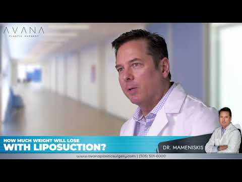 How much weight will lose with liposuction? - Dr. Mameniskis