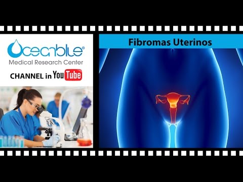 Vídeo: Fibromas: Tipos, Causas Y Síntomas