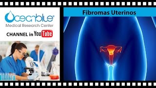 Brote desencadenantes fibroma de