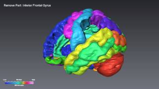 Surface Rendering Brain Selection