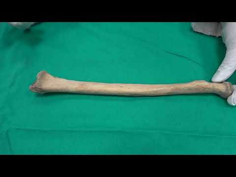 Anatomi Kemikler-Üst Ekstremite Kemikleri- Os Radius Anatomisi (kemikler anatomi)