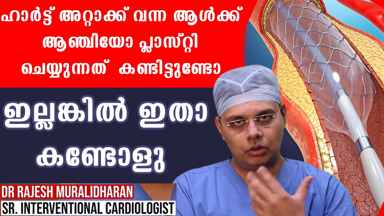 ഹാര്‍ട്ട് അറ്റാക്ക്‌ വന്ന ഒരാള്‍ക്ക് ആന്‍ജിയോ പ്ലാസ്റ്റി ചെയ്യുന്നത് കണ്ടിട്ടുണ്ടോ ഇല്ലങ്കില്‍ ഇതാ