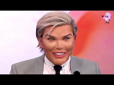 Thumbnail for 10 Craziest Plastic Surgeries You Have to See to Believe