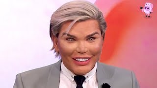 10 Craziest Plastic Surgeries You Have to See to Believe