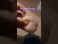 parte 2