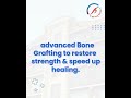 Bone Grafting at Health Pillar Hospitals