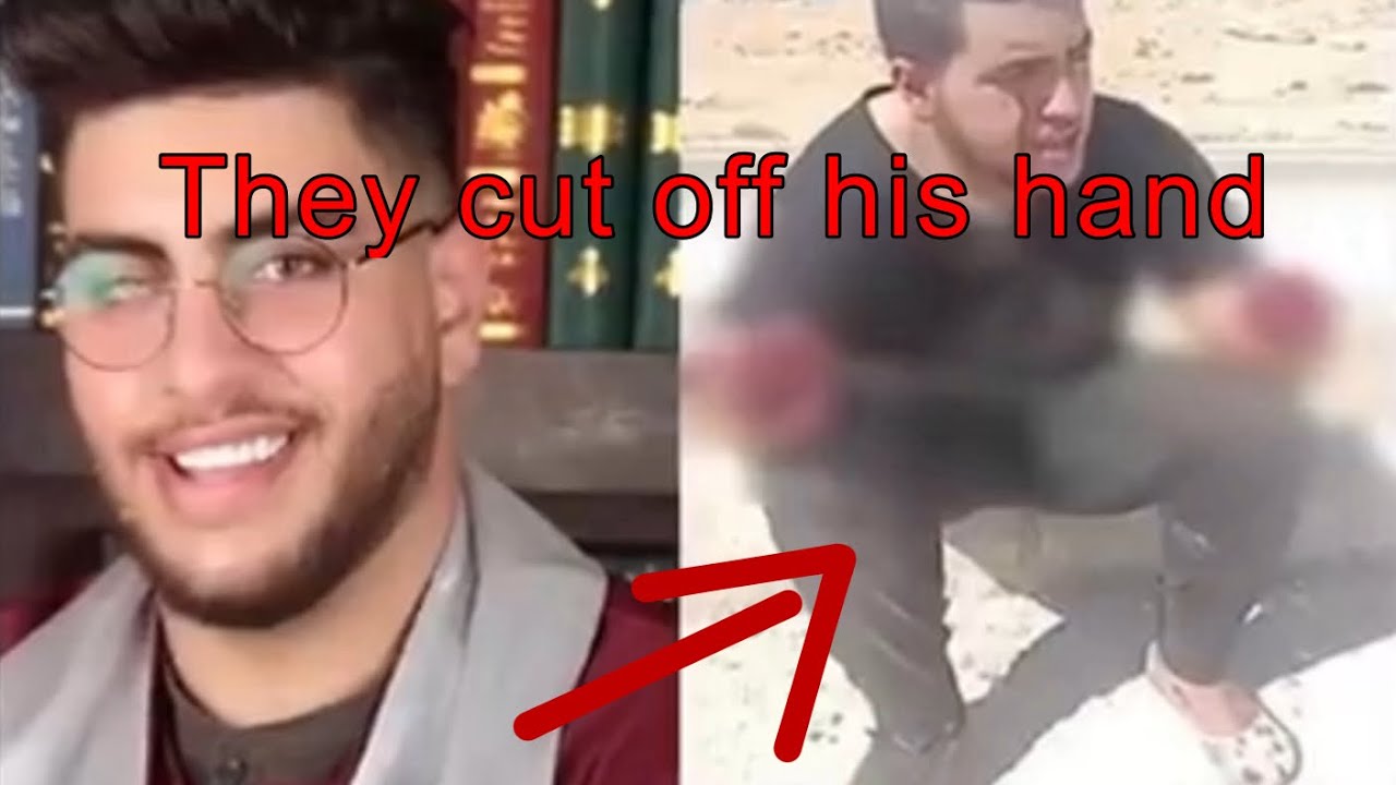 A YouTuber Whose Hand Was Cut Off Because of Revenge❗️