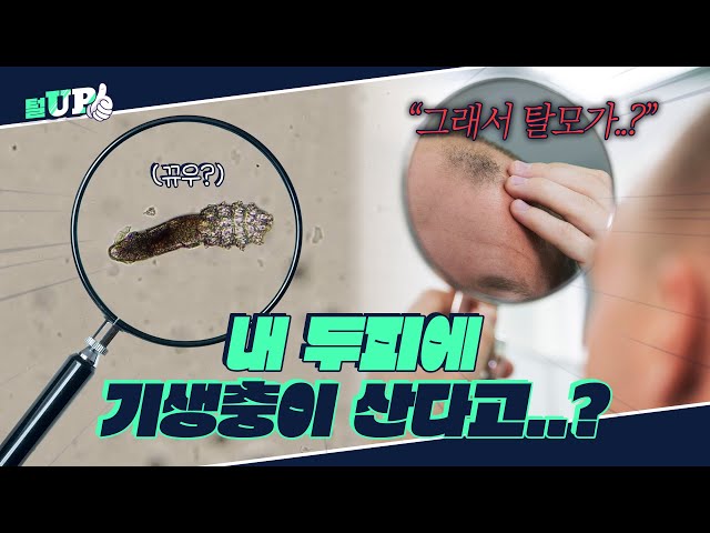 모낭충과 탈모의 연관성ㅣ#면역력 키우기ㅣ두피청결 탈모관리ㅣ모모성형외과ㅣ모모의원 강동우 대표원장