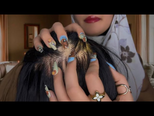 ASMR Scalp Scratching No Talking Only Mouth Sounds 💆🏻‍♀️💦 (satisfying scalp massage)