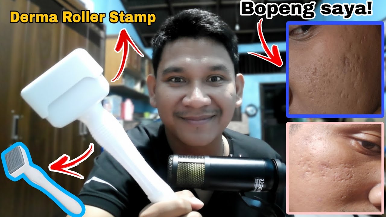 RAHASIA TERLARANG! CARA PAKAI DERMA ROLLER STAMP YANG BIKIN BOPENG SAYA AKAN RATA 😳 05/10/25 #1