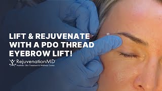 Get a Non-Surgical Brow Lift with PDO Threads!