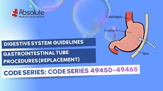 Digestive System — Gastrointestinal Tube Procedures Coding (Guidelines) (Code Series 49440–49442)
