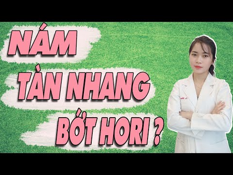 Nám da - Tàn nhang - Nám chân sâu - Bớt Hori?| Phân biệt đúng để biết cách xử lý| Bs Nguyễn Ngọc