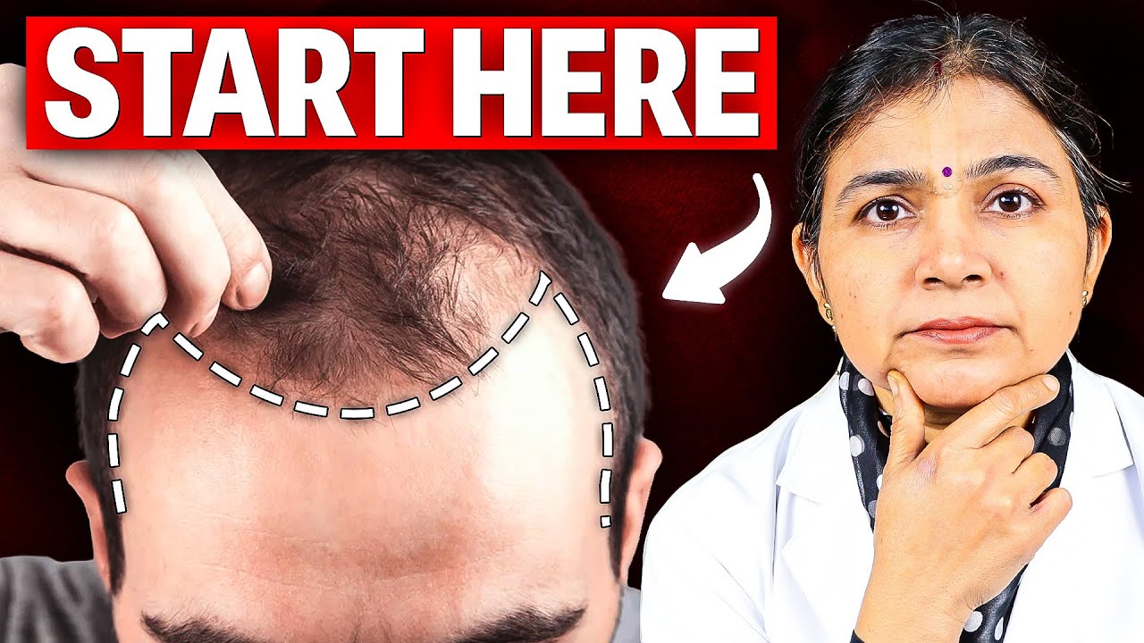 Возможно ли естественное восстановление роста волос? Обратное отступление линии роста волос | Бол...