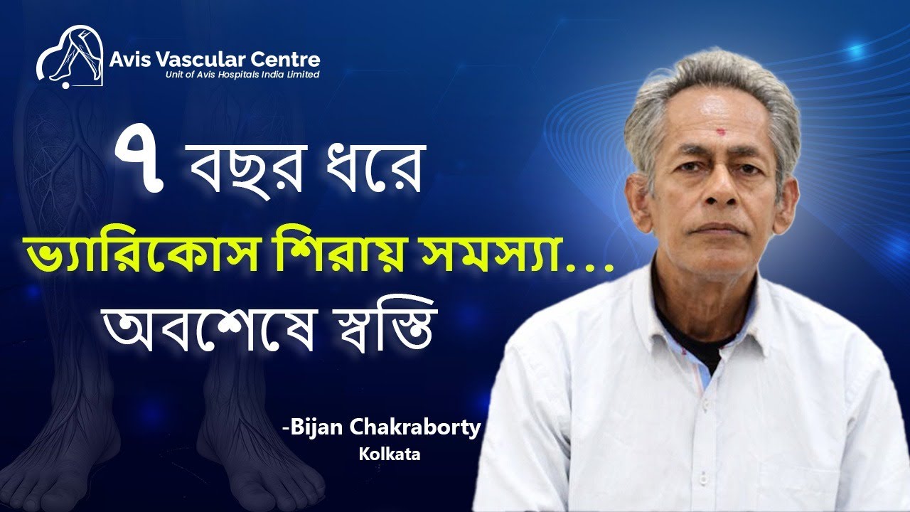 ৭ বছর ধরে  ভেরিকোজ ভেইন থেকে আরাম | Avis Hospitals Kolkata