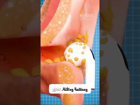 اكبر اضرار سماعة الاذن معلومات معلومة معلومات عامة حقائق حقايق