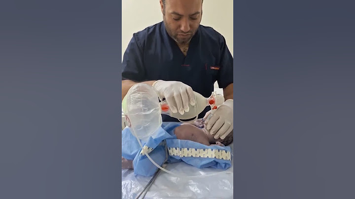 Nefes Kesen Anlar! Bebeği Hayata Döndürdü Milyonlar İzledi - Mavi Kadın #shots