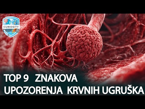 Video: Upozorenja i savjeti o putovanju u Grčku