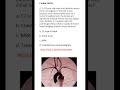 Medicine & Surgery MCQs (For MBBS, USMLE, MCCQE & PLAB)