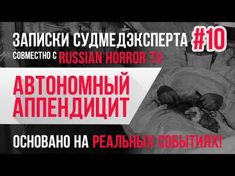 Видео: Записки Судмедэксперта #10 "Автономный Аппендицит". Страшная История на Реальных Событиях