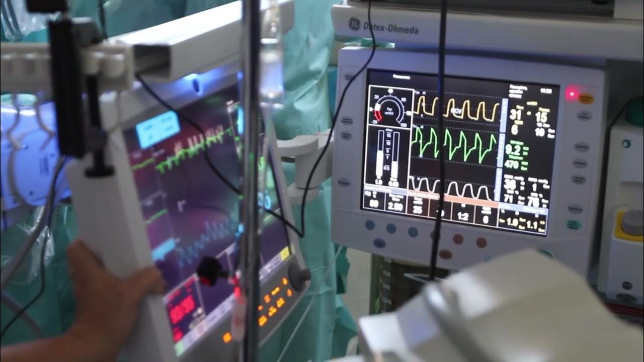 In operation threater checking bp heart beat youtube