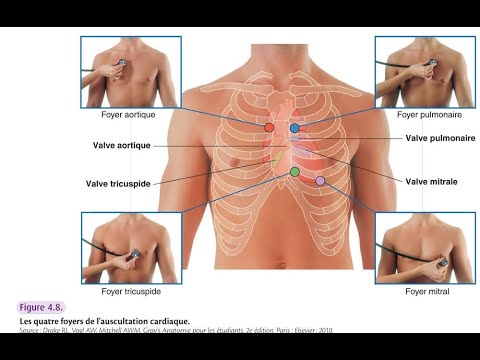 Les foyers d'auscultation cardiaque