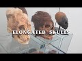 Elongated skulls