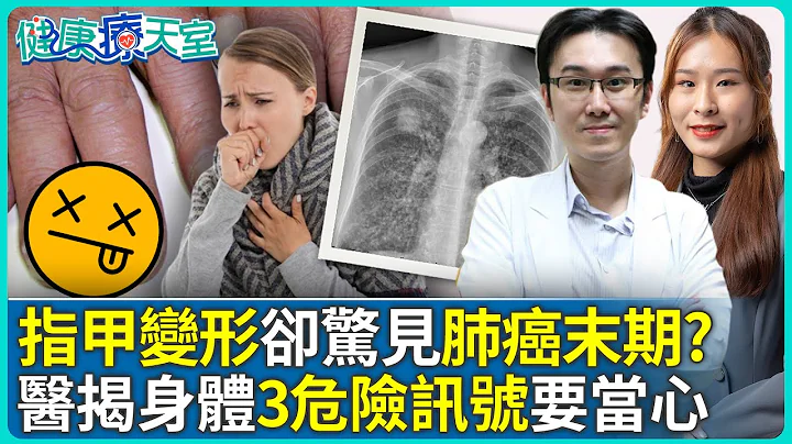 【健康疗天室】指甲变形却惊见肺癌末期？　医揭身体3危险讯号要当心 @ChinaTimes - 天天要闻