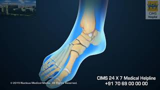 Ankle Scope – CIMS Hospital