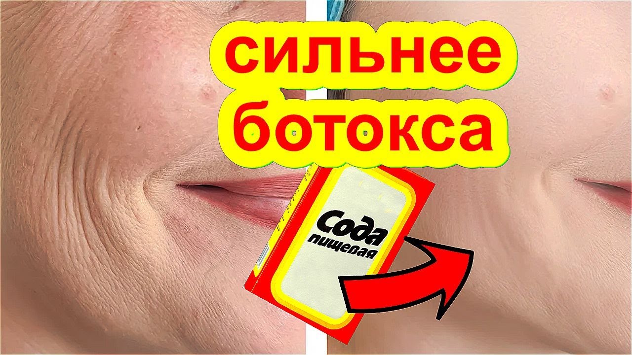 СИЛЬНЕЕ Ботокса Маска с Содой ! Омолодила на 10 Лет Маска для Лица от ...