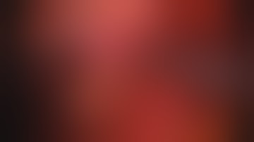 SA-35 LAPAROSCOPIC RADICAL CYCTECTOMY - NATURAL ORIFICE SPECIMEN EXTRACTION (NOSE), SERDAR AYKAN, MD