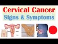 How to detect cervical cancer ? ll Symptoms and Risk Factors of Cervical Cancer ll Cervical Cancer