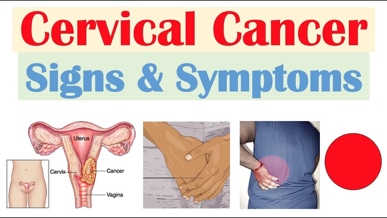 How to detect cervical cancer ? ll Symptoms and Risk Factors of ...