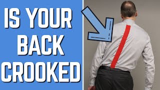 Back Pain/Sciatica? Does Your Back Look Crooked? You Need to Fix This First