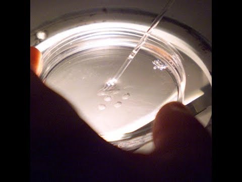 pix What Does A Human Egg Cell Look Like primitive human eggs matured in the lab for the first time