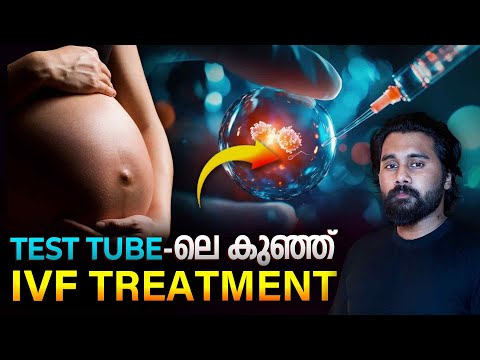 IVF Explained in Malayalam | In Vitro Fertilization Process & Treatment
